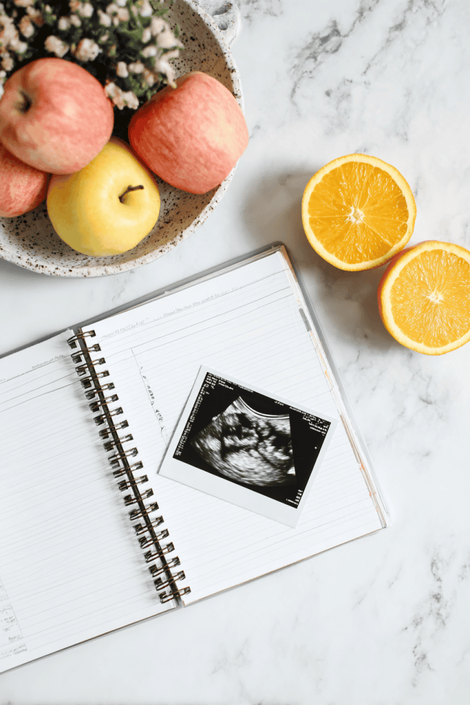 Open journal with pregnancy notes, ultrasound photo, prenatal vitamins and fresh fruit nearby